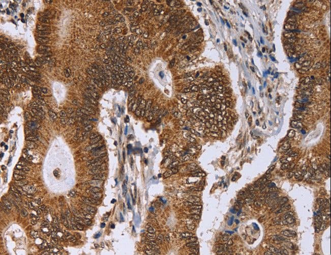 ERCC6L / FLJ20105 Antibody