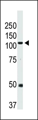Polyclonal Rabbit anti-Human BMPR2 Antibody (aa28-59, IHC, WB)