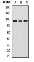 FER Antibody (Internal)