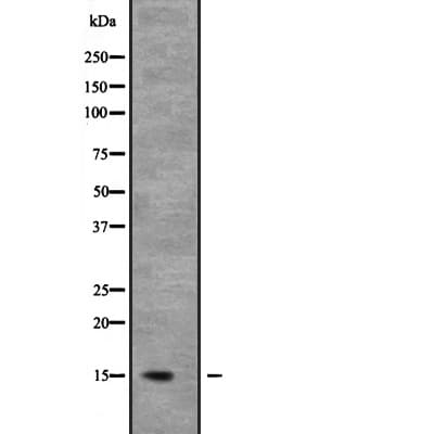 Polyclonal Rabbit anti-Human NDUFB6 Antibody (WB)