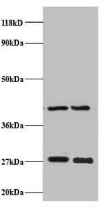 NDUFV2 Antibody