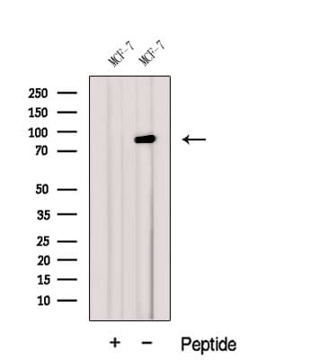 Polyclonal Rabbit anti-Human GGCX Antibody (IF, WB)