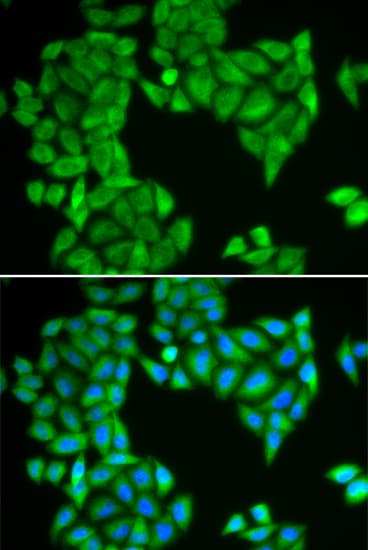 SPAG5 / MAP126 Antibody