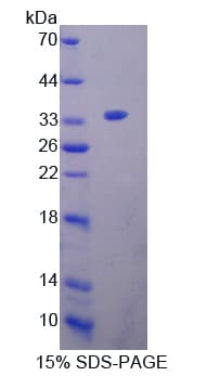 Rat OIT3 Protein (Recombinant His-T7)