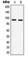 HSP90B1 / GP96 / GRP94 Antibody (C-Terminus)