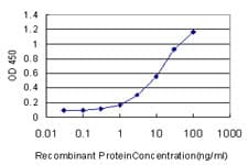 MAGEA3 Antibody (clone 6D10)