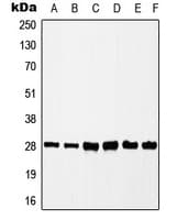 CSNK2B / Phosvitin Antibody (phospho-Ser209)