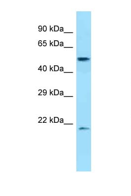 Dipeptidase 2 / DPEP2 Antibody (aa401-450)