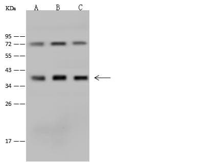 PQBP1 Antibody