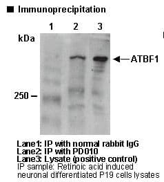 IHC-plus™ Polyclonal Rabbit anti-Human ZFHX3 / ATBF1 Antibody (IHC, IF, WB)