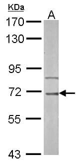 IRAK3 / IRAKM / IRAK-M Antibody (aa58-357)