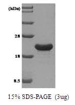 Human TPD52L1 Protein (Recombinant His)