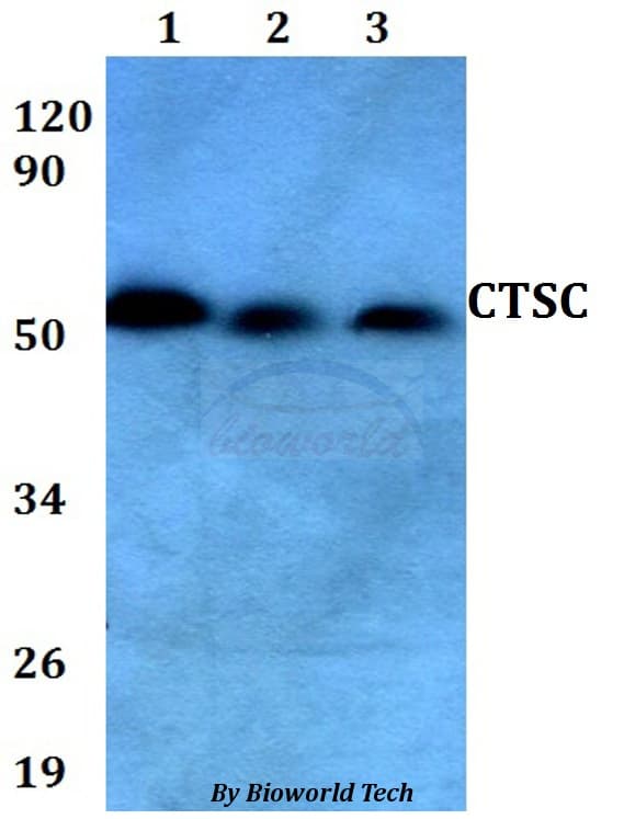 Polyclonal Rabbit anti-Human CTSC / Cathepsin C / JP Antibody (WB)