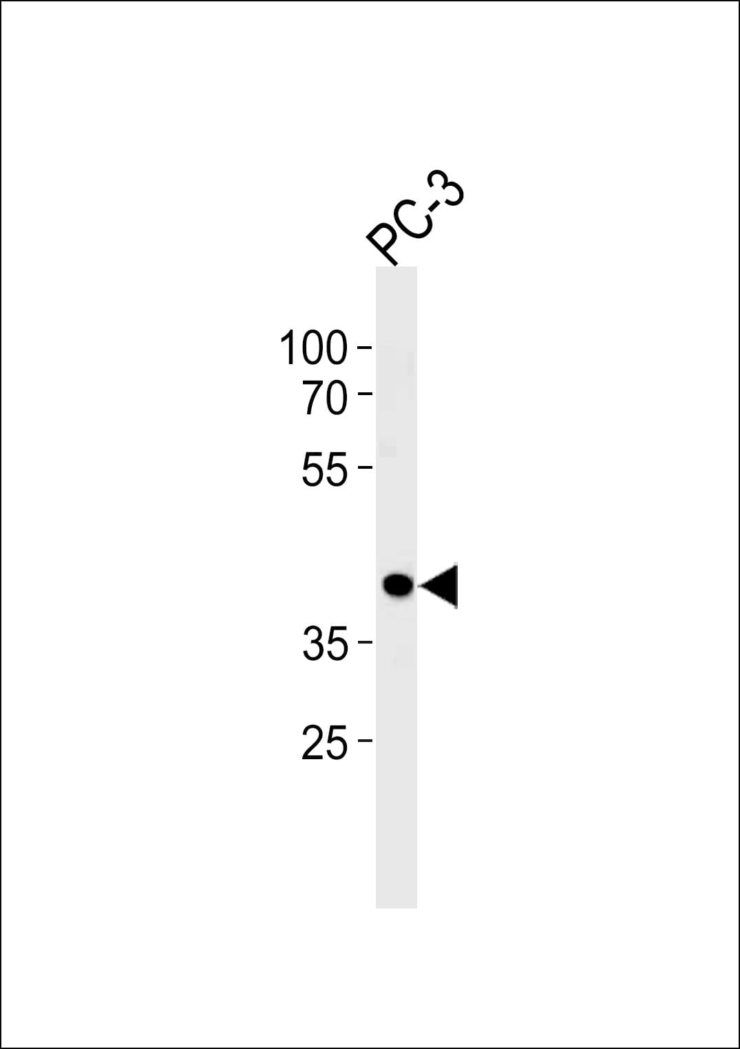 CREB3L4 / AIBZIP Antibody (aa338-366)