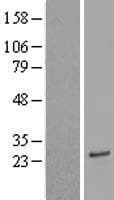 ACER1 / ASAH3 Protein (Over-Expression Lysate Myc-DDK (Flag))