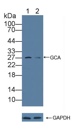 GCL / Grancalcin Antibody (aa1-139)