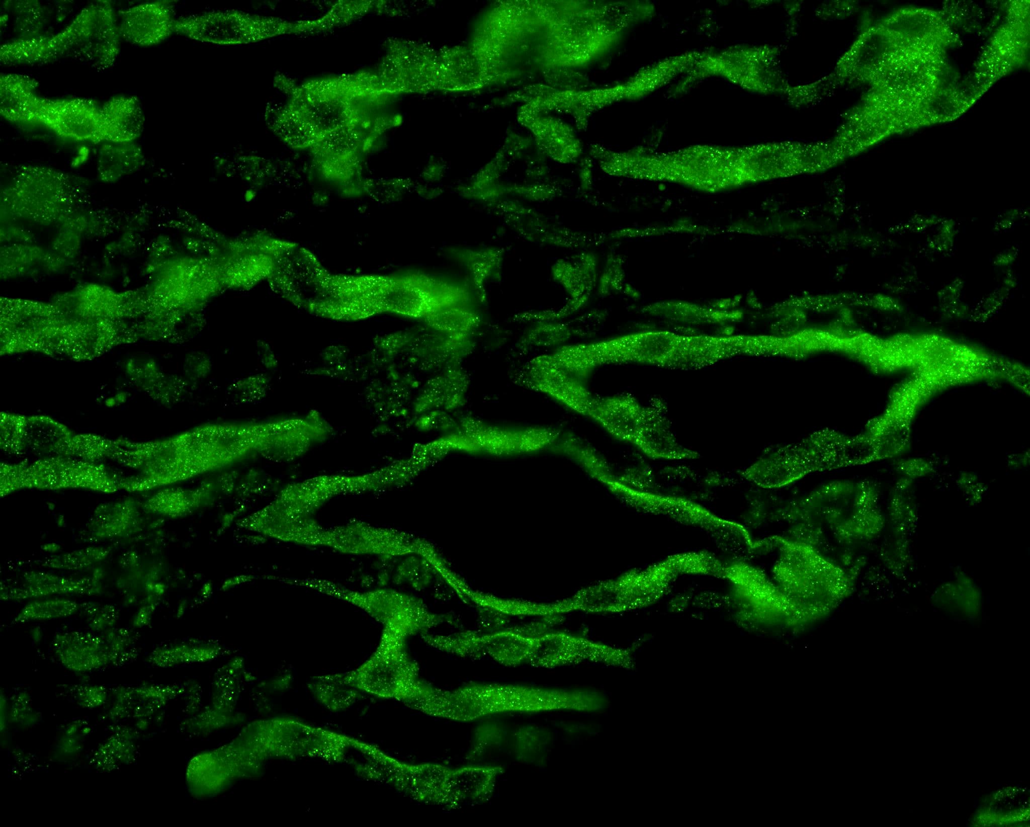 AQP4 / Aquaporin 4 Antibody