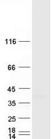 Human RHBDD1 Protein (Recombinant Myc-DDK (Flag))