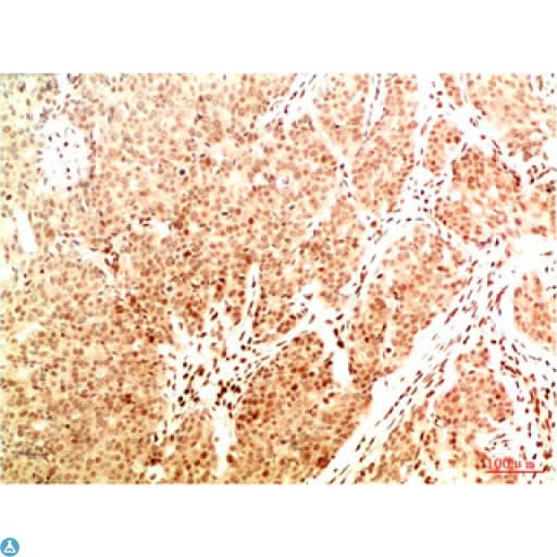 Monoclonal Mouse anti-Human RELA / NFKB p65 Antibody (WB)