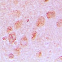 RPL17 / Ribosomal Protein L17 Antibody (Internal)