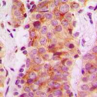 Polyclonal Rabbit anti-Human RABEP2 Antibody (Internal, IHC, WB)
