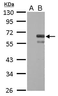 Polyclonal Rabbit anti-Human F10 / Factor X Antibody (aa33-312, IHC, WB)