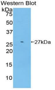GSTM2 Antibody (aa5-202, FITC)