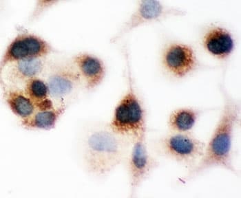 Polyclonal Rabbit anti-Human BID Antibody (aa1-195, IHC, WB)