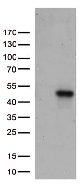 CD74 / CLIP Antibody (clone UMAB231)