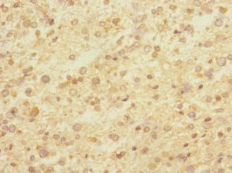 Polyclonal Rabbit anti-Human CNTNAP1 / CASPR / p190 Antibody (IHC, WB)