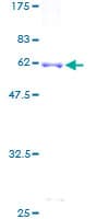 Human IDS / Iduronate 2 Sulfatase Protein (Recombinant GST)