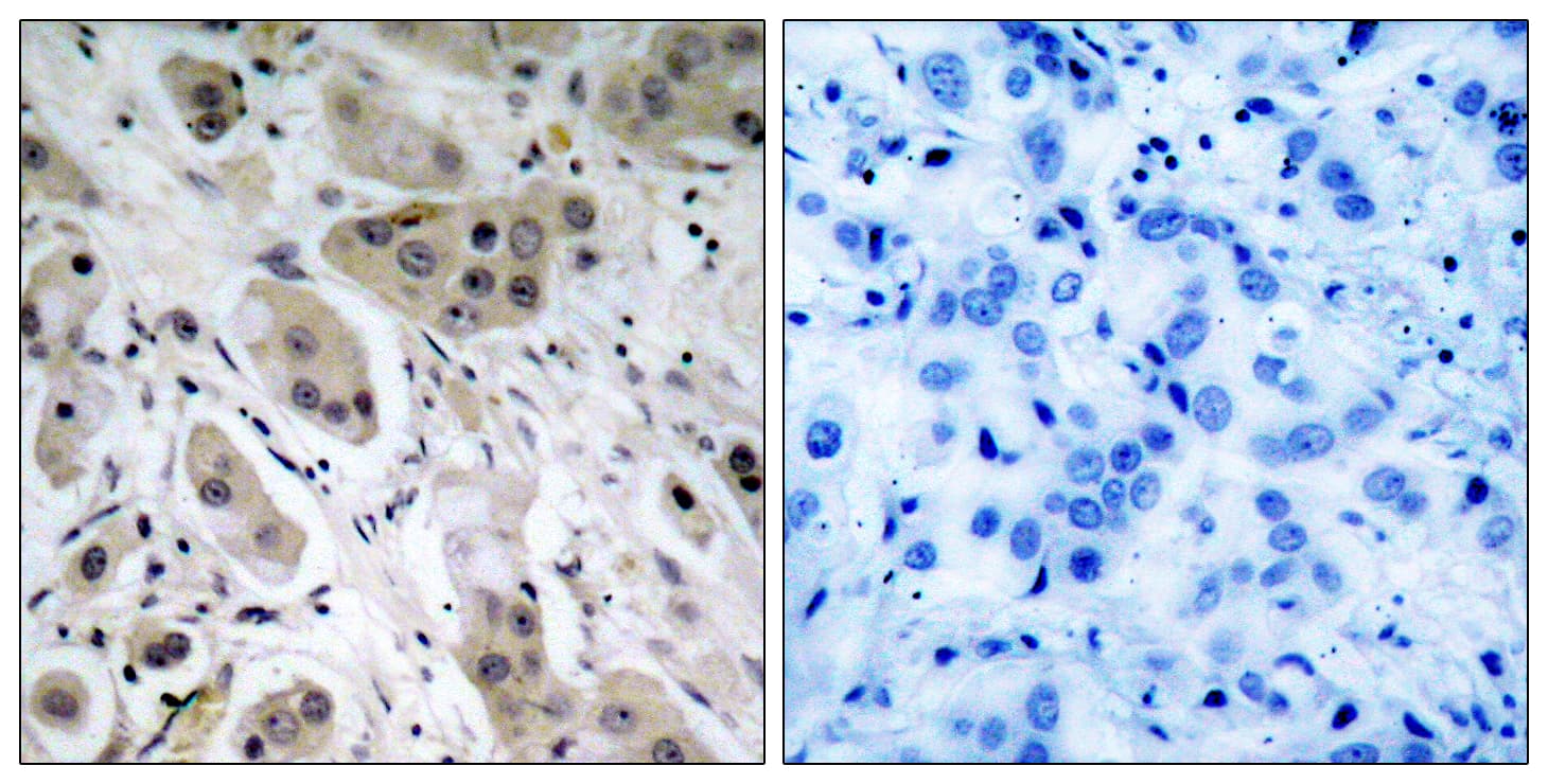 AKT1 + AKT2 + AKT3 Antibody (phospho-Ser473)