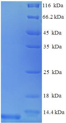 Mouse CCL3 / MIP-1-Alpha Protein (Recombinant His)