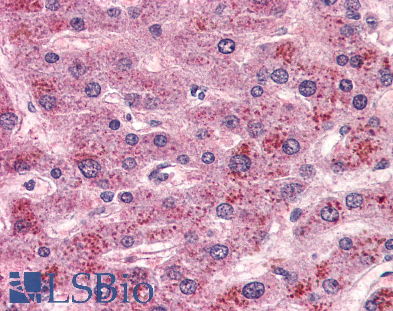 IHC-plus™ Polyclonal Rabbit anti-Human BOB / GPR15 Antibody (Extracellular Domain, IHC)