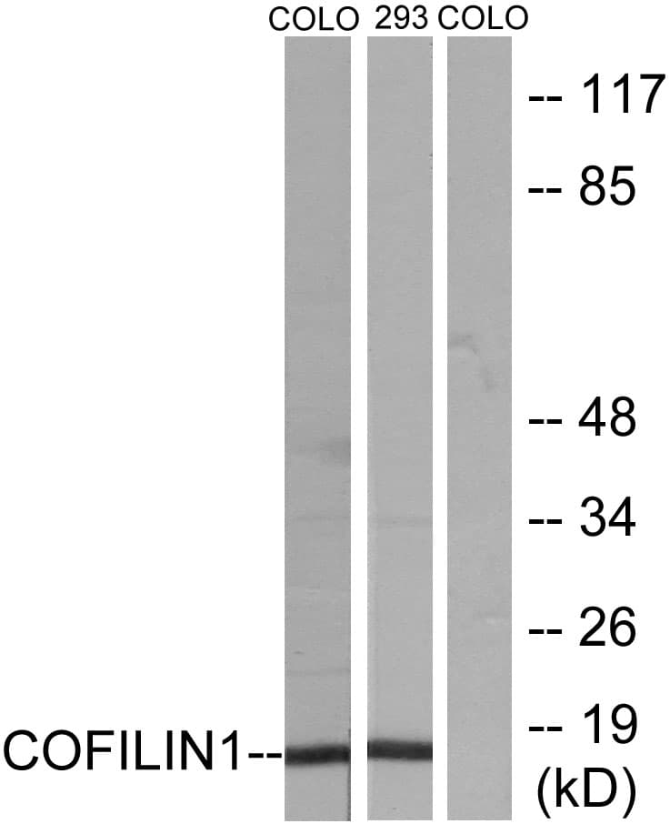 CFL1 / Cofilin Antibody (aa1-50)