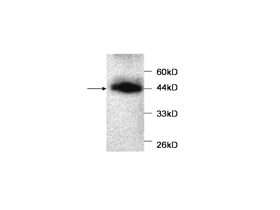 MB / Myoglobin Antibody
