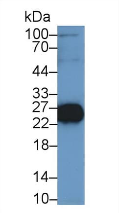 TNNI2 Antibody (aa1-182)