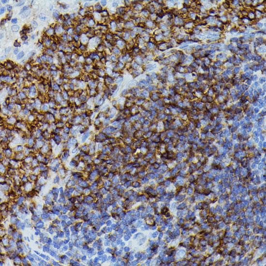 APOC3 / Apolipoprotein C III Antibody