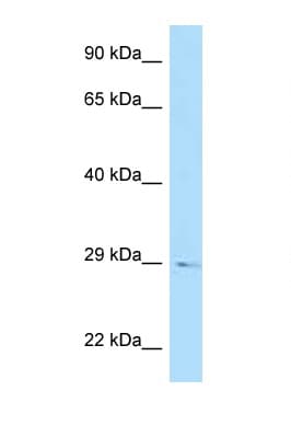 RGS20 / RGSZ1 Antibody (aa59-108)