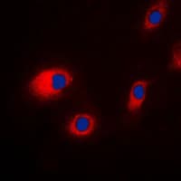 Polyclonal Rabbit anti-Human CLC-7 / CLCN7 Antibody (N-Terminus, IF, WB)