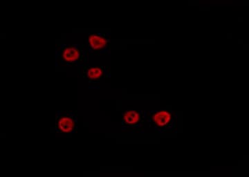 TEAD3 Antibody
