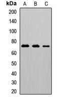 IL5RA / CD125 Antibody