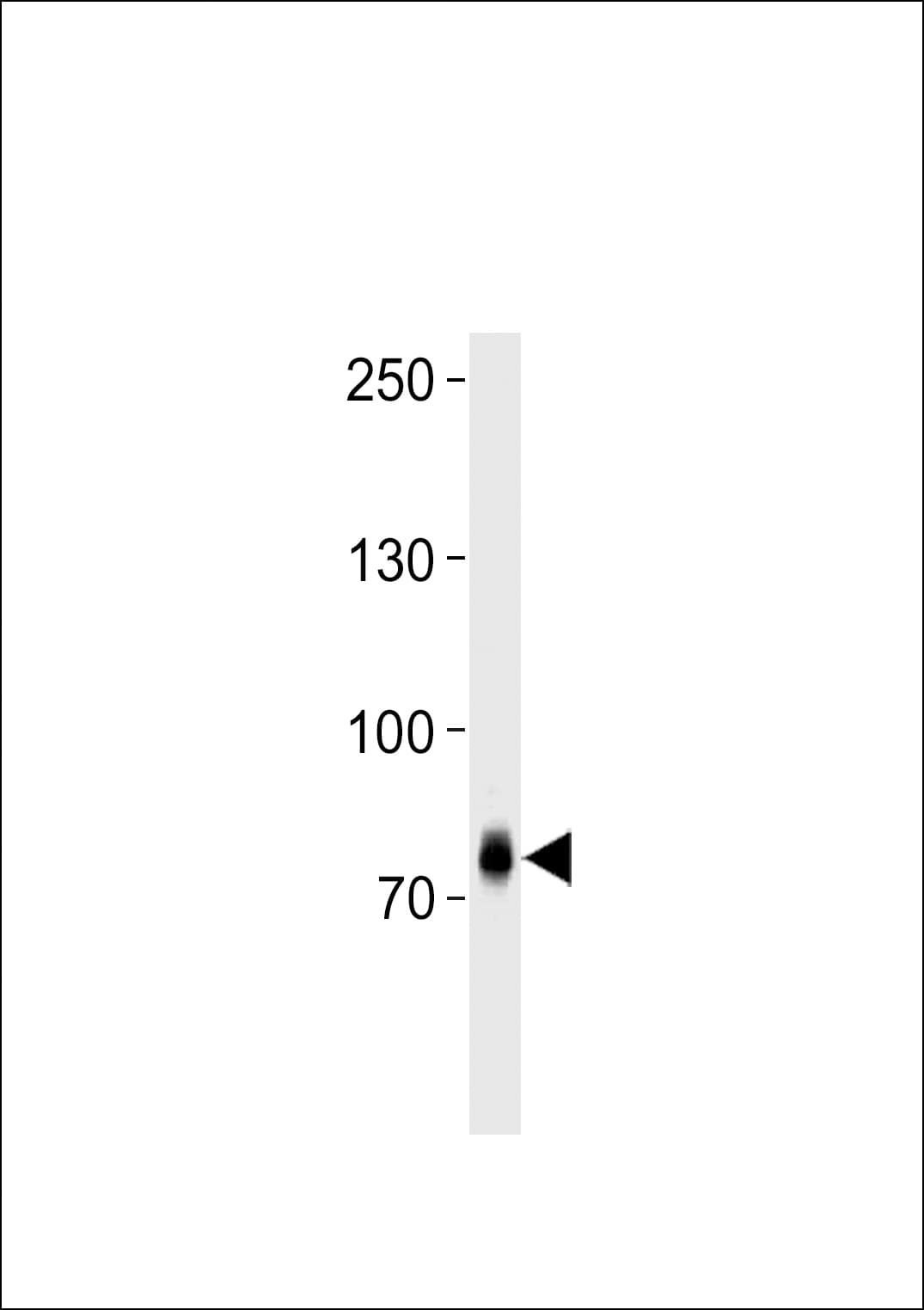 ZFP219 / ZNF219 Antibody (aa653-682)