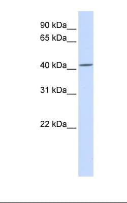 Polyclonal Rabbit anti-Human BAP / SIL1 Antibody (aa360-409, IHC, WB)