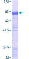 Human ESRRG / ERR Gamma Protein (Recombinant GST)