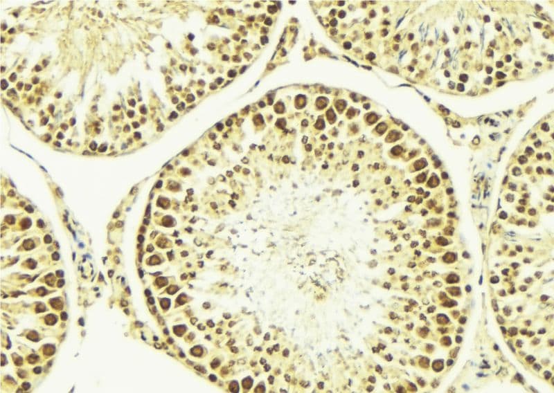 NBN / Nibrin Antibody