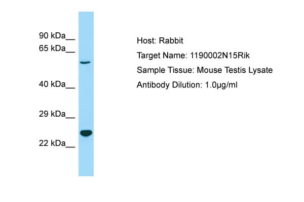 C3orf58 Antibody (aa85-134)