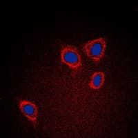 PathPlus™ CAV1 / Caveolin 1 Antibody (C-Terminus)