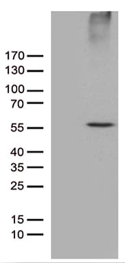 RNF14 / ARA54 Antibody (aa1-220, clone OTI3A4)