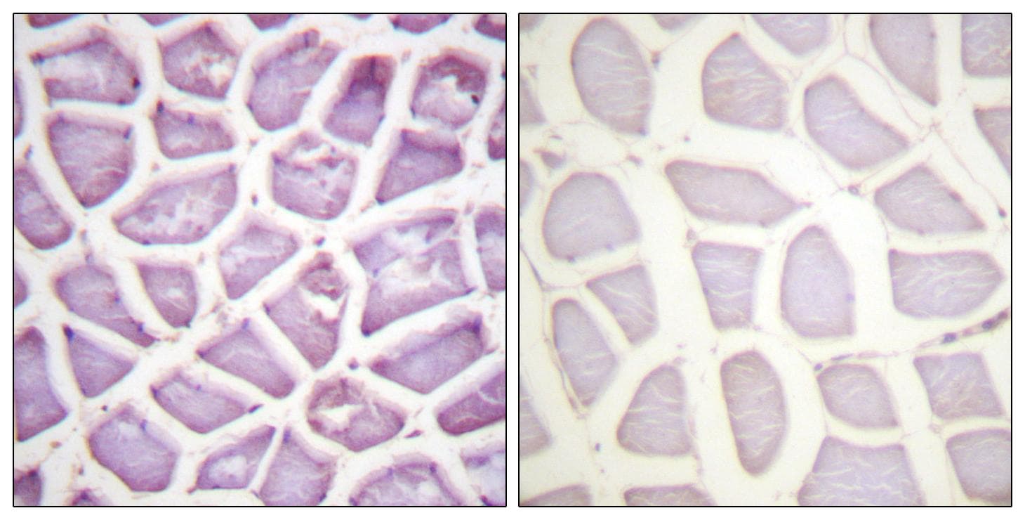 PARK2 / Parkin 2 Antibody (phospho-Ser131)